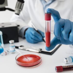 coronavirus-vaccine-composition-in-lab coronavirus-vaccine-composition-in-lab